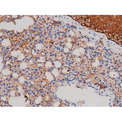 Phospho-AKT1 (Ser124) Antibody in Immunohistochemistry (Paraffin) (IHC (P))