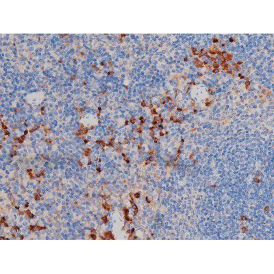 Phospho-AKT1 (Ser124) Antibody in Immunohistochemistry (Paraffin) (IHC (P))