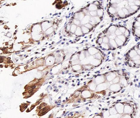 Phospho-AKT1/AKT2/AKT3 (Thr308) Antibody in Immunohistochemistry (Paraffin) (IHC (P))