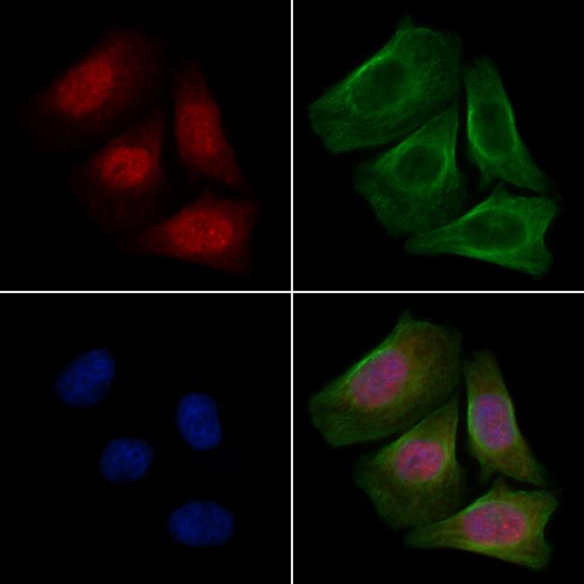 Phospho-AKT2 (Ser474) Antibody in Immunocytochemistry (ICC/IF)