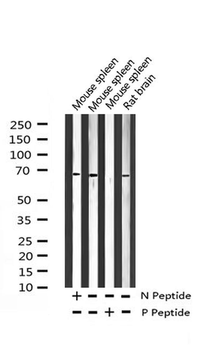 Phospho-NF2 (Ser518) Antibody in Western Blot (WB)