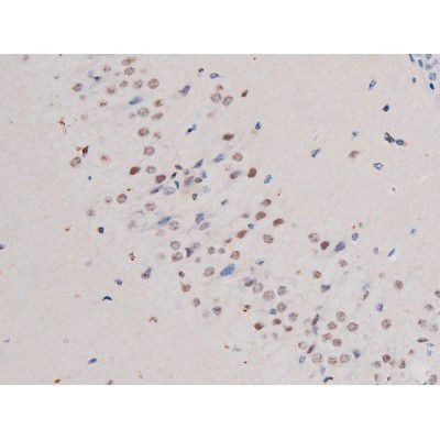 Phospho-IRS1 (Ser636) Antibody in Immunohistochemistry (Paraffin) (IHC (P))