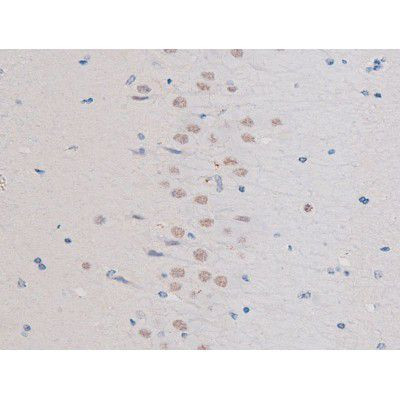 Phospho-IRS1 (Ser636) Antibody in Immunohistochemistry (Paraffin) (IHC (P))