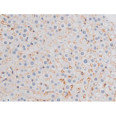 Phospho-IRS1 (Ser636) Antibody in Immunohistochemistry (Paraffin) (IHC (P))