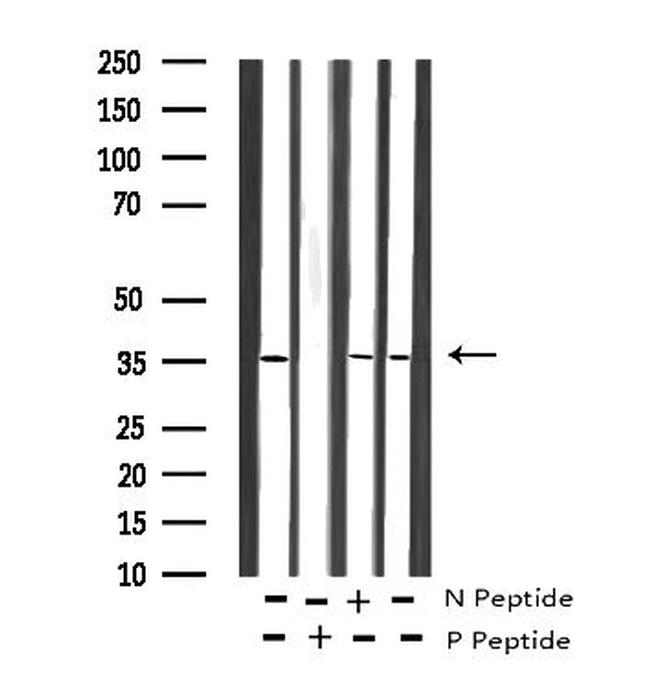 Phospho-IRS1 (Ser636) Antibody in Western Blot (WB)