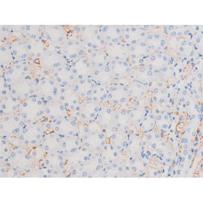 Phospho-IRS1 (Ser639) Antibody in Immunohistochemistry (Paraffin) (IHC (P))