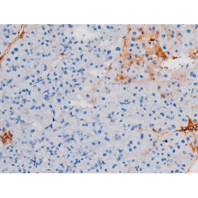 Phospho-IRS1 (Ser639) Antibody in Immunohistochemistry (Paraffin) (IHC (P))