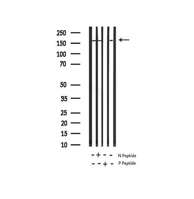 Phospho-IRS1 (Ser639) Antibody in Western Blot (WB)