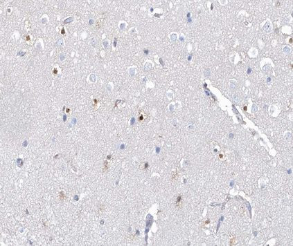 Phospho-AHR (Ser36) Antibody in Immunohistochemistry (Paraffin) (IHC (P))