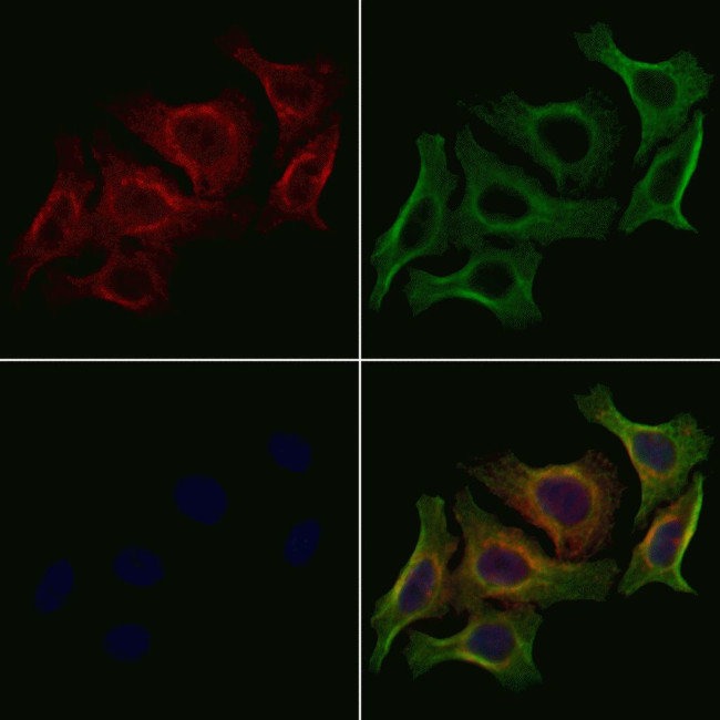 Phospho-VEGF Receptor 2 (Tyr1059) Antibody in Immunocytochemistry (ICC/IF)