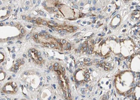 Phospho-VEGF Receptor 2 (Tyr951) Antibody in Immunohistochemistry (Paraffin) (IHC (P))