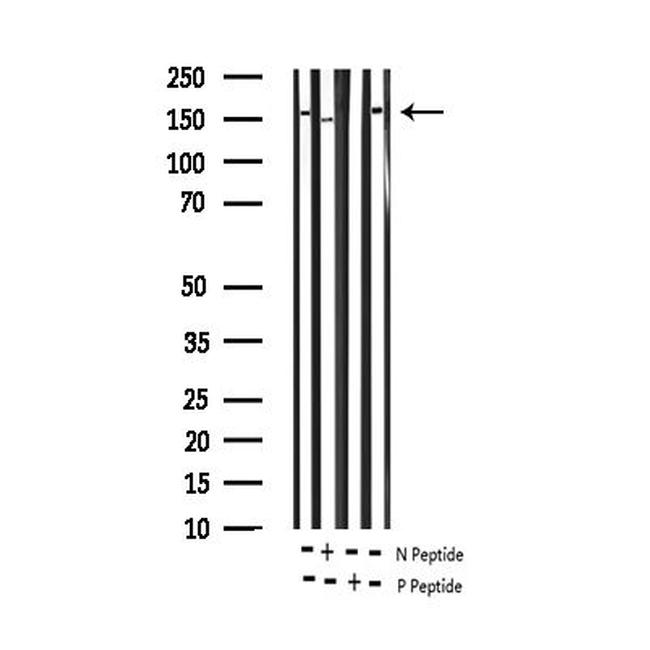 Phospho-VEGF Receptor 2 (Tyr951) Antibody in Western Blot (WB)
