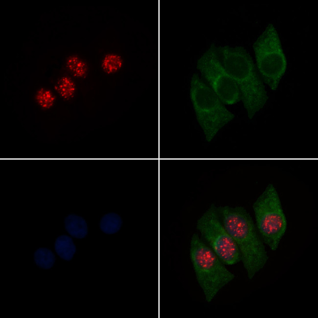 Phospho-PPAR gamma (Ser112) Antibody in Immunocytochemistry (ICC/IF)