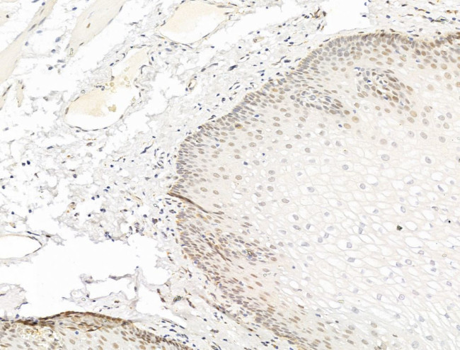 Phospho-PPAR gamma (Ser112) Antibody in Immunohistochemistry (Paraffin) (IHC (P))