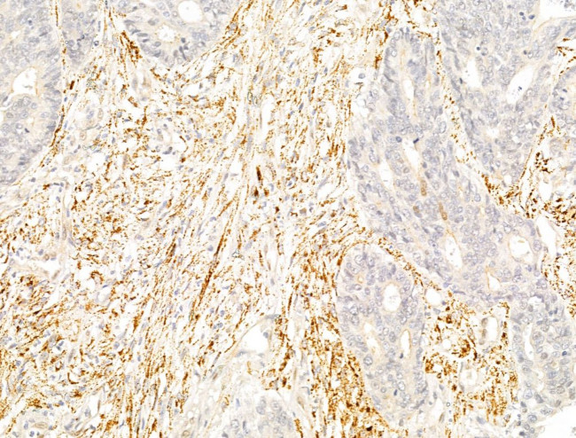 Phospho-PPAR gamma (Ser112) Antibody in Immunohistochemistry (Paraffin) (IHC (P))