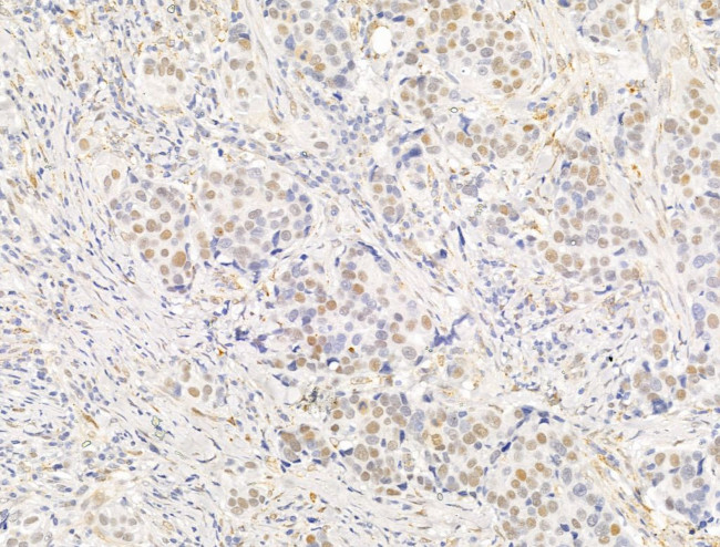 Phospho-PPAR gamma (Ser112) Antibody in Immunohistochemistry (Paraffin) (IHC (P))