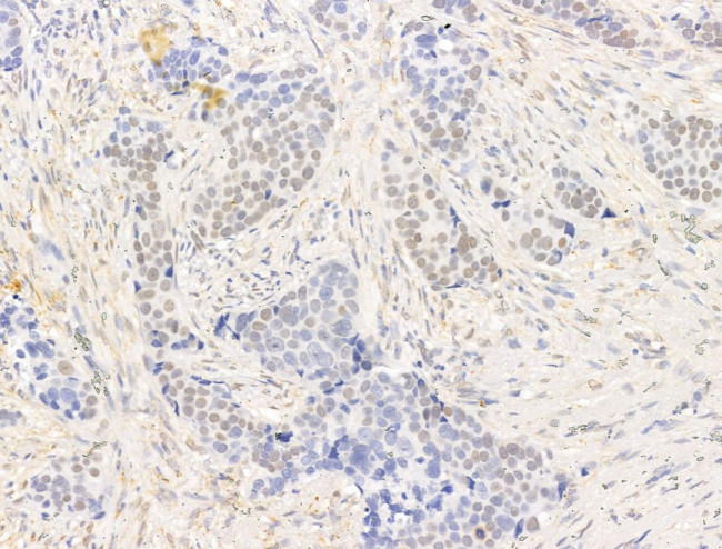 Phospho-PPAR gamma (Ser112) Antibody in Immunohistochemistry (Paraffin) (IHC (P))