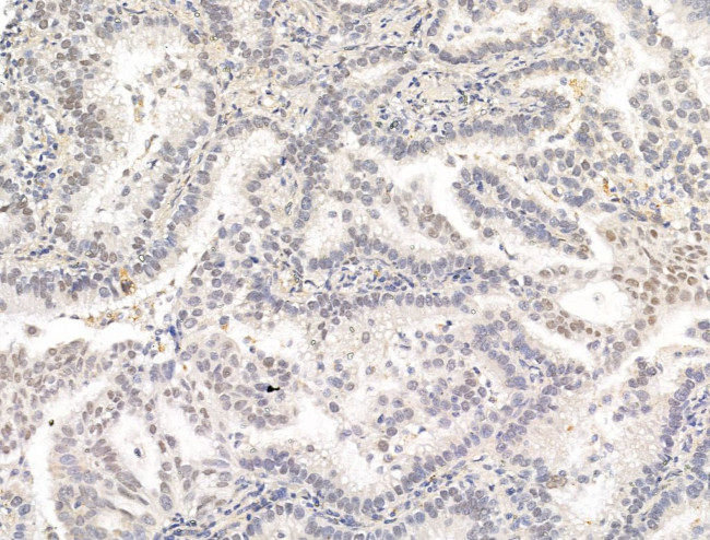 Phospho-PPAR gamma (Ser112) Antibody in Immunohistochemistry (Paraffin) (IHC (P))