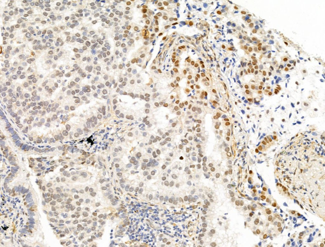 Phospho-PPAR gamma (Ser112) Antibody in Immunohistochemistry (Paraffin) (IHC (P))