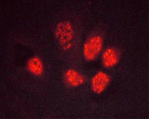 Phospho-PPAR gamma (Ser112) Antibody in Immunocytochemistry (ICC/IF)