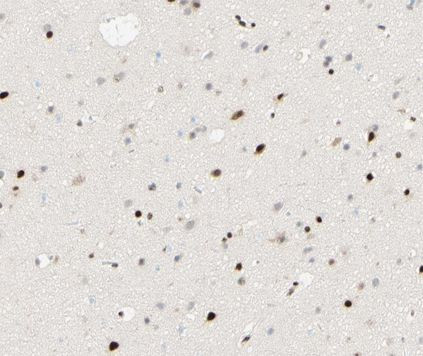 Phospho-PPAR gamma (Ser112) Antibody in Immunohistochemistry (Paraffin) (IHC (P))