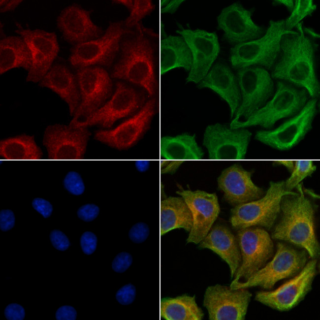 Phospho-Alpha-synuclein (Ser129) Antibody in Immunocytochemistry (ICC/IF)