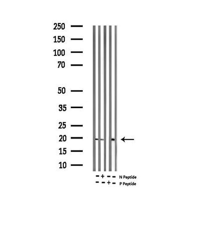 Phospho-Alpha-synuclein (Ser129) Antibody in Western Blot (WB)