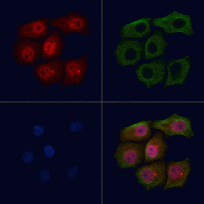 Phospho-BRCA1 (Ser1524) Antibody in Immunocytochemistry (ICC/IF)