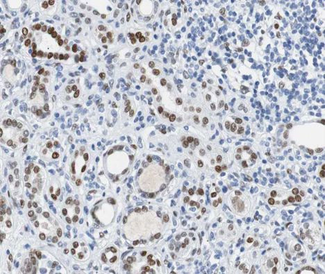 Phospho-BRCA1 (Ser1524) Antibody in Immunohistochemistry (Paraffin) (IHC (P))