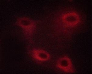 Phospho-TPL2 (Thr290) Antibody in Immunocytochemistry (ICC/IF)