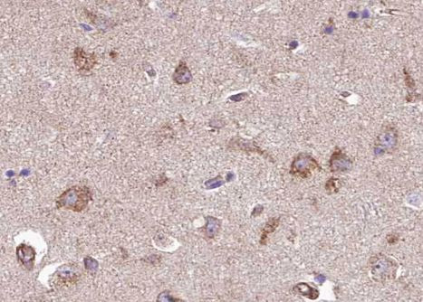 Phospho-TPL2 (Thr290) Antibody in Immunohistochemistry (Paraffin) (IHC (P))