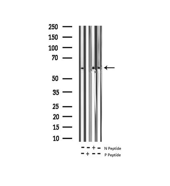 Phospho-TPL2 (Thr290) Antibody in Western Blot (WB)