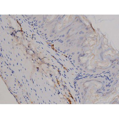 Phospho-STAT6 (Tyr641) Antibody in Immunohistochemistry (Paraffin) (IHC (P))