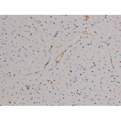 Phospho-STAT6 (Tyr641) Antibody in Immunohistochemistry (Paraffin) (IHC (P))