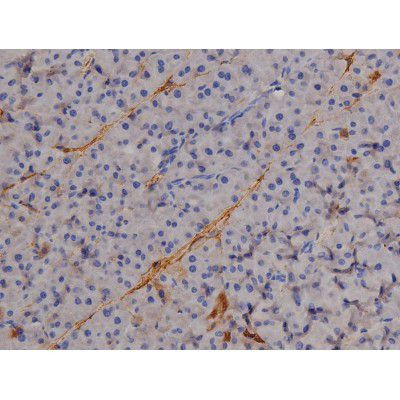 Phospho-STAT6 (Tyr641) Antibody in Immunohistochemistry (Paraffin) (IHC (P))