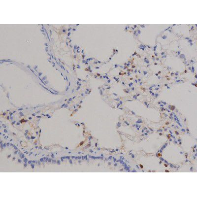 Phospho-STAT6 (Tyr641) Antibody in Immunohistochemistry (Paraffin) (IHC (P))