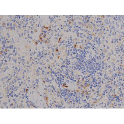 Phospho-STAT6 (Tyr641) Antibody in Immunohistochemistry (Paraffin) (IHC (P))