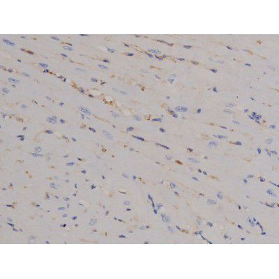 Phospho-STAT6 (Tyr641) Antibody in Immunohistochemistry (Paraffin) (IHC (P))