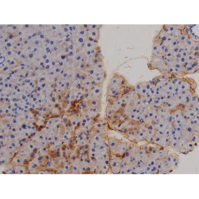 Phospho-STAT6 (Tyr641) Antibody in Immunohistochemistry (Paraffin) (IHC (P))