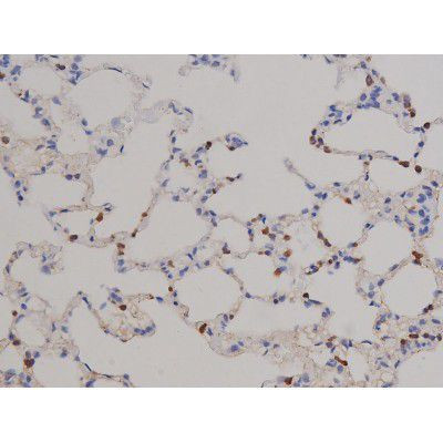 Phospho-STAT6 (Tyr641) Antibody in Immunohistochemistry (Paraffin) (IHC (P))