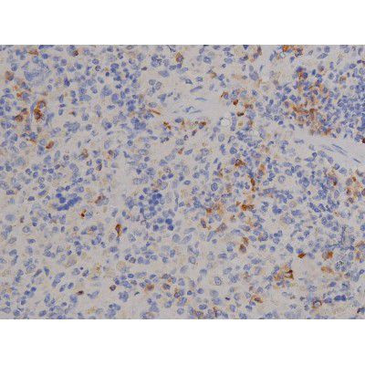 Phospho-STAT6 (Tyr641) Antibody in Immunohistochemistry (Paraffin) (IHC (P))