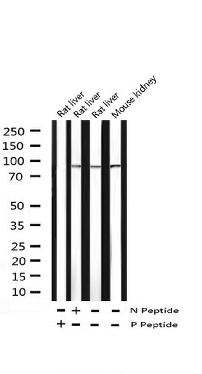 Phospho-STAT6 (Tyr641) Antibody in Western Blot (WB)