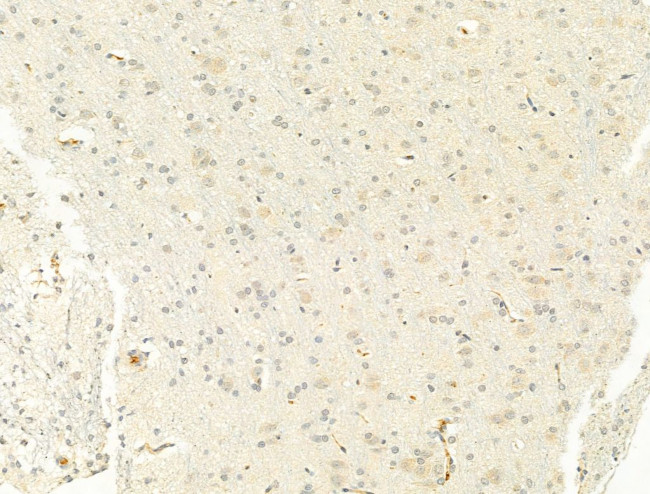 Phospho-STAT6 (Tyr641) Antibody in Immunohistochemistry (Paraffin) (IHC (P))