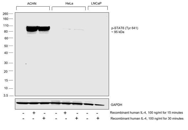 Phospho-STAT6 (Tyr641) Antibody in Western Blot (WB)