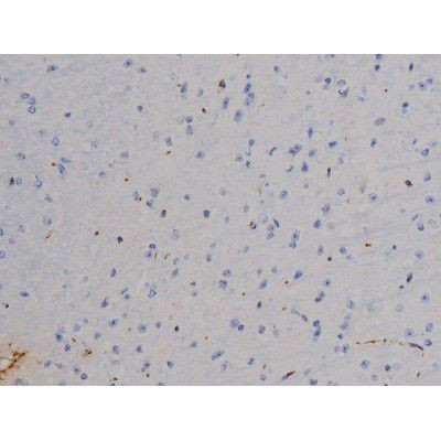 Phospho-STAT6 (Thr645) Antibody in Immunohistochemistry (Paraffin) (IHC (P))