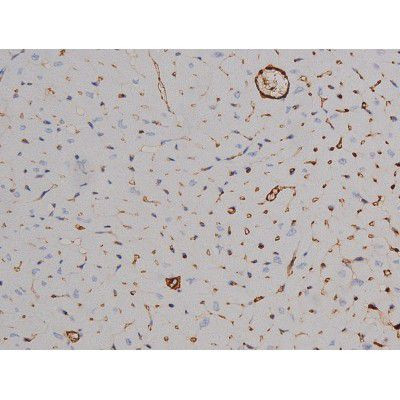 Phospho-STAT6 (Thr645) Antibody in Immunohistochemistry (Paraffin) (IHC (P))