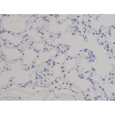 Phospho-STAT6 (Thr645) Antibody in Immunohistochemistry (Paraffin) (IHC (P))