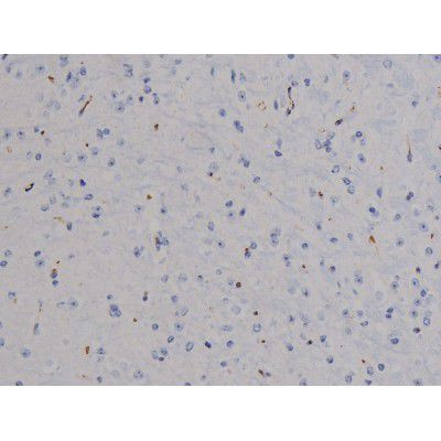 Phospho-STAT6 (Thr645) Antibody in Immunohistochemistry (Paraffin) (IHC (P))