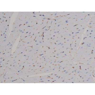 Phospho-STAT6 (Thr645) Antibody in Immunohistochemistry (Paraffin) (IHC (P))