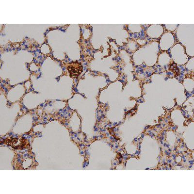 Phospho-STAT6 (Thr645) Antibody in Immunohistochemistry (Paraffin) (IHC (P))